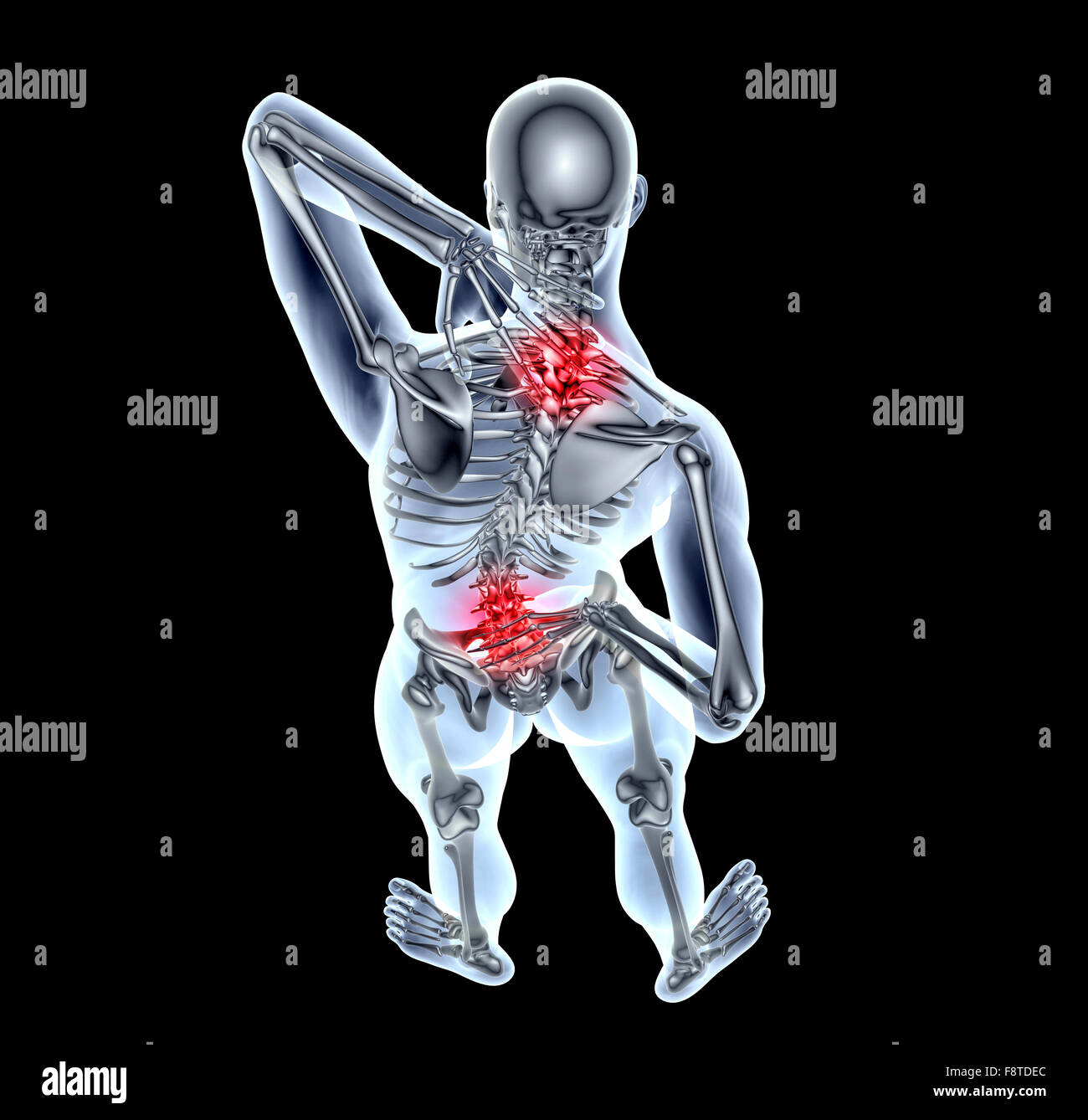 https://c8.alamy.com/comp/F8TDEC/x-ray-image-of-a-man-with-back-pain-on-black-with-clipping-path-F8TDEC.jpg