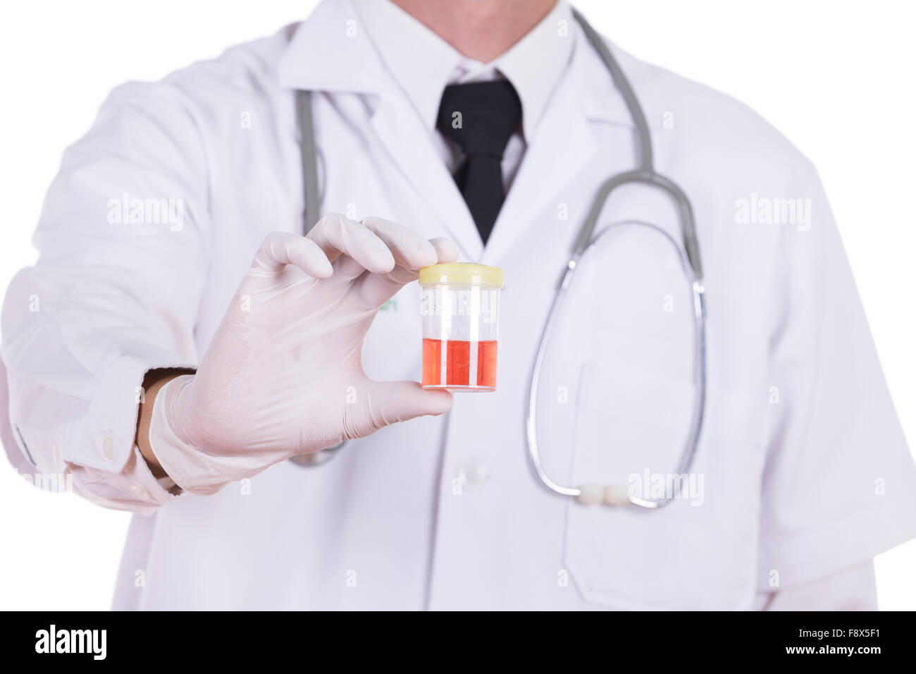 doctor's hand holding a bottle of bloody urine sample isolated on white