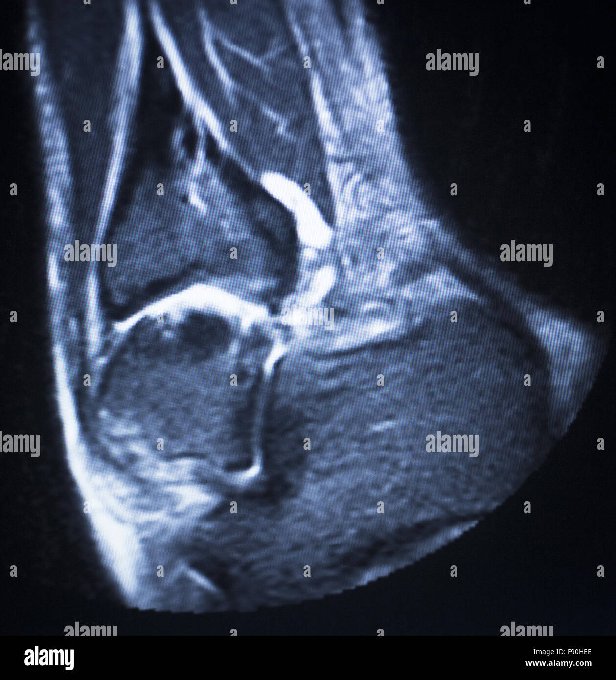 MRI resonance imaging medical scan test results showing