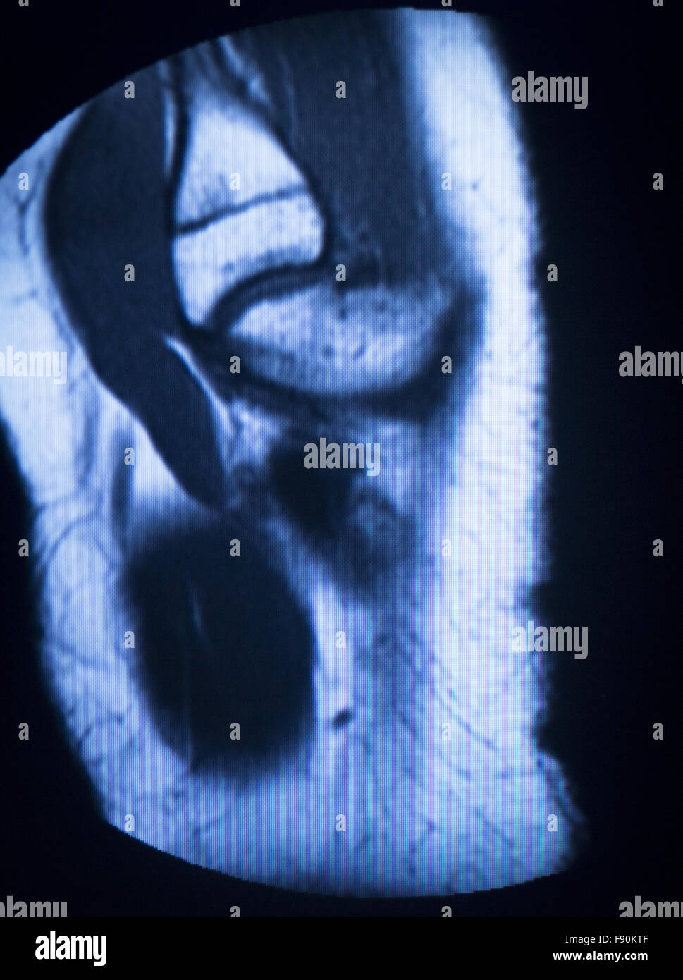 MRI resonance imaging medical scan test results showing knee