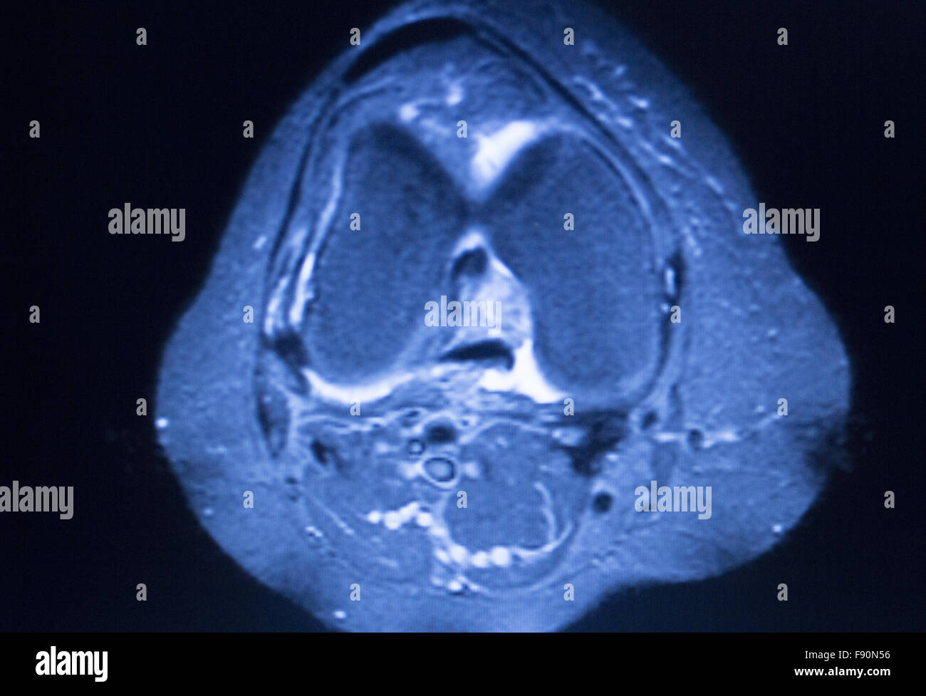 MRI resonance imaging medical scan test results showing