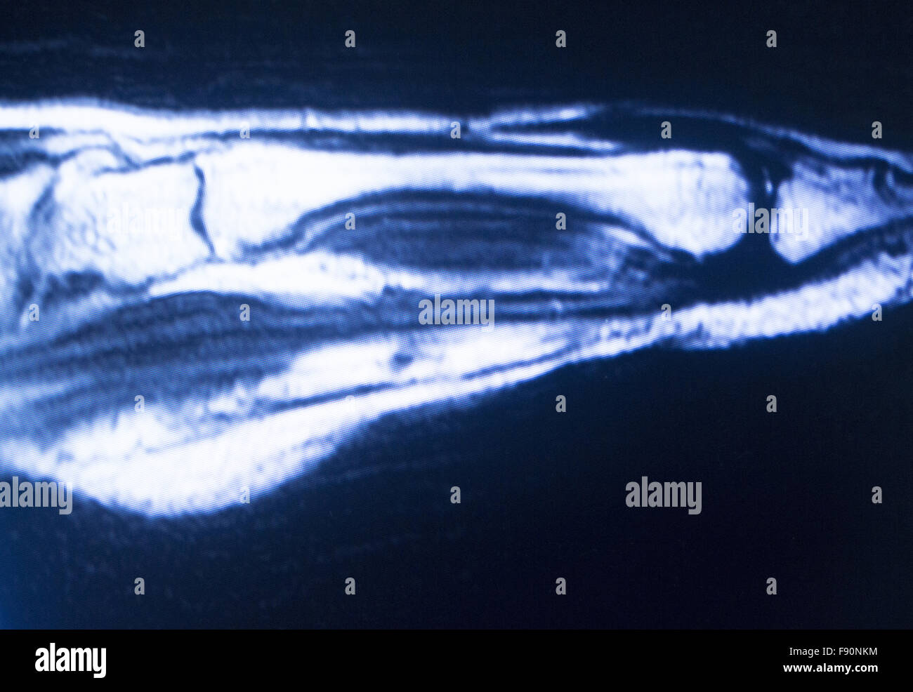 MRI resonance imaging medical scan test results showing