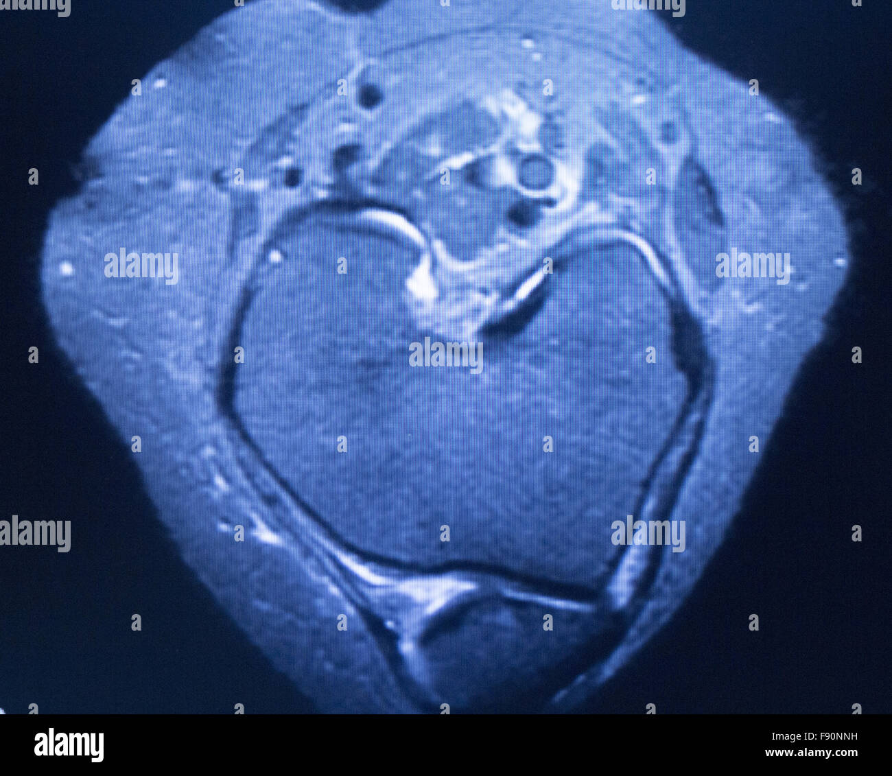 MRI resonance imaging medical scan test results showing
