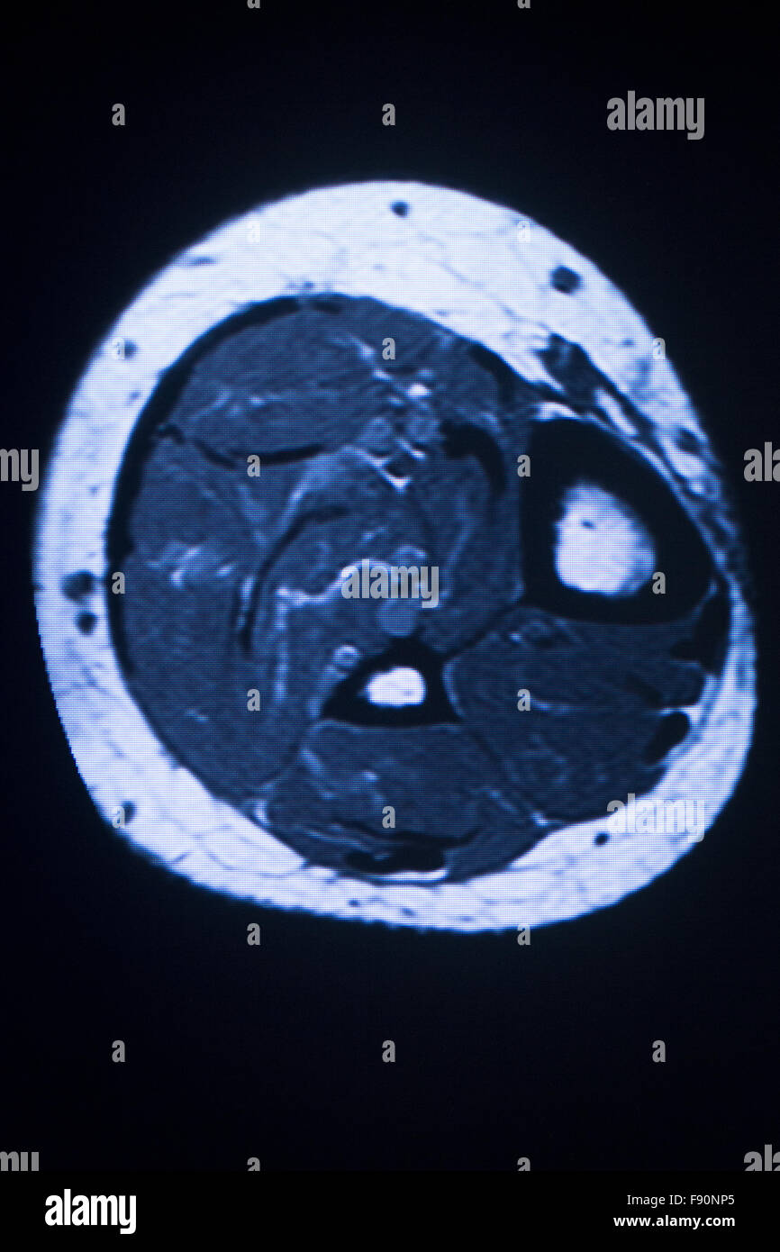 MRI resonance imaging medical scan test results showing