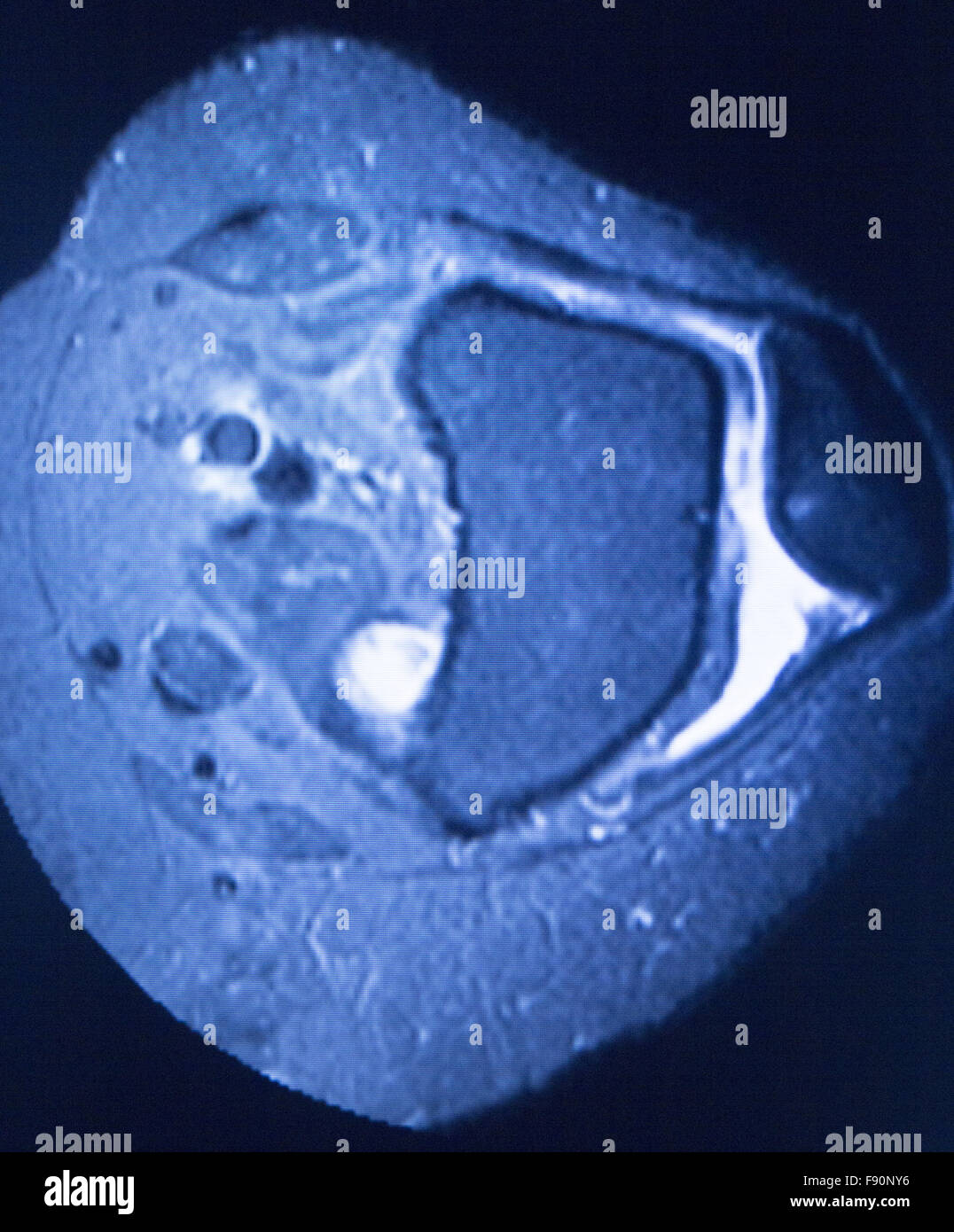 MRI resonance imaging medical scan test results showing