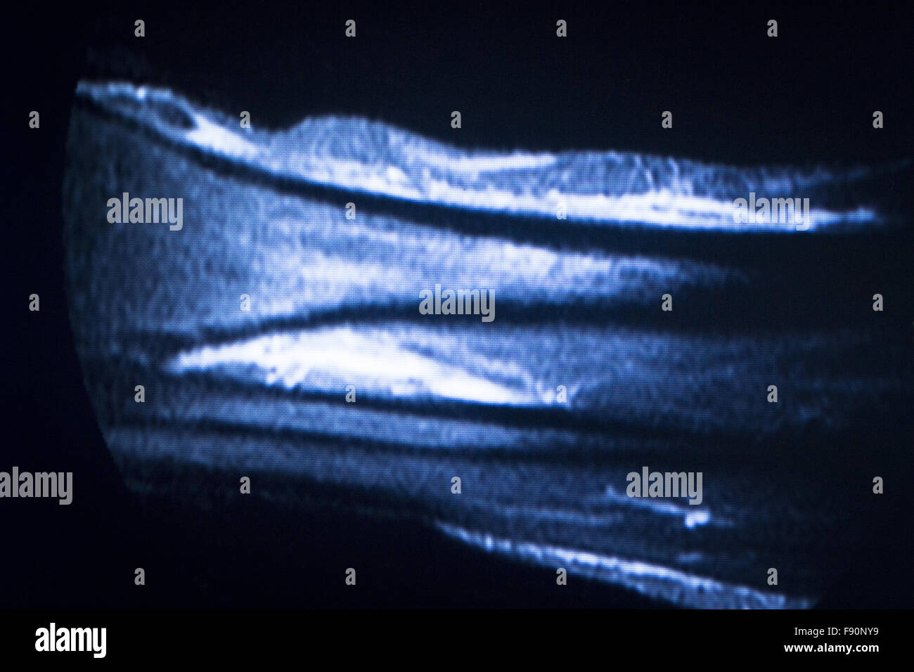 MRI resonance imaging medical scan test results showing
