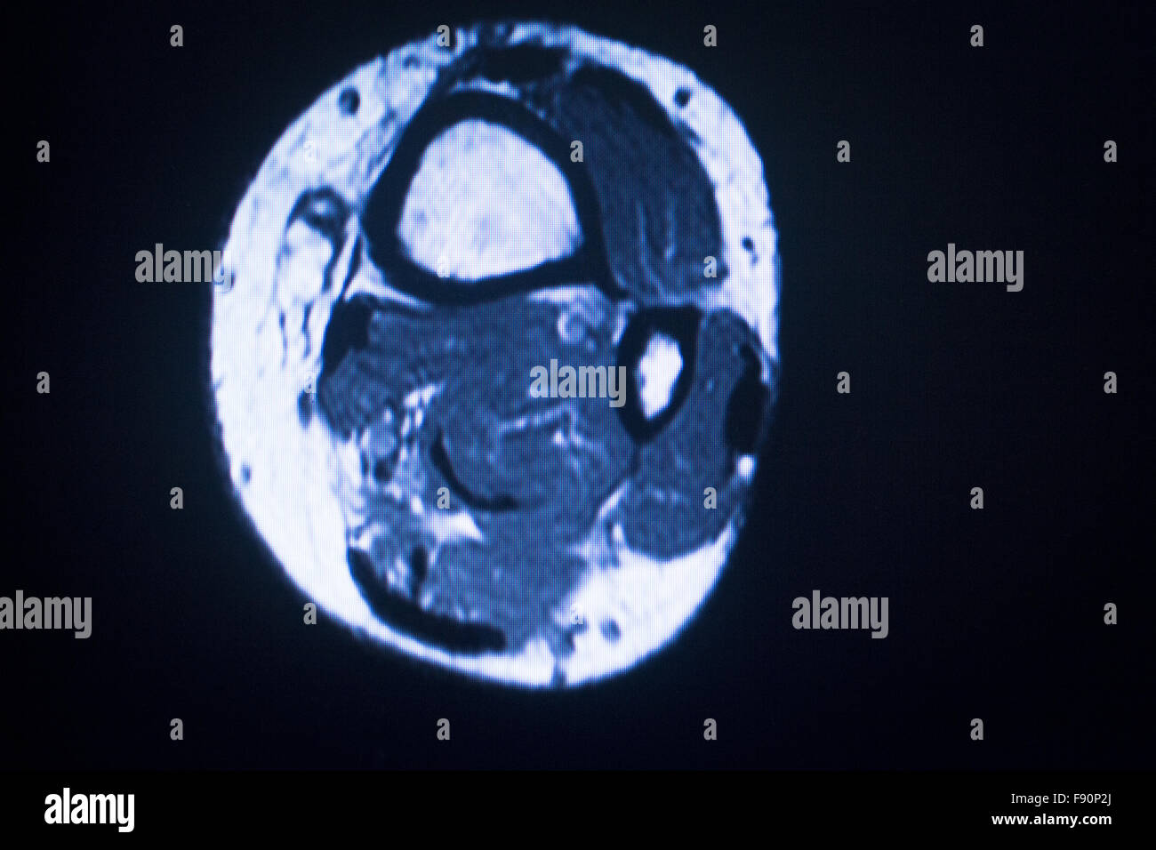 Mri Magnetic Resonance Imaging Medical Scan Test Results Showing 