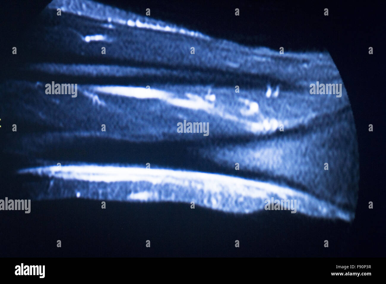 MRI resonance imaging medical scan test results showing