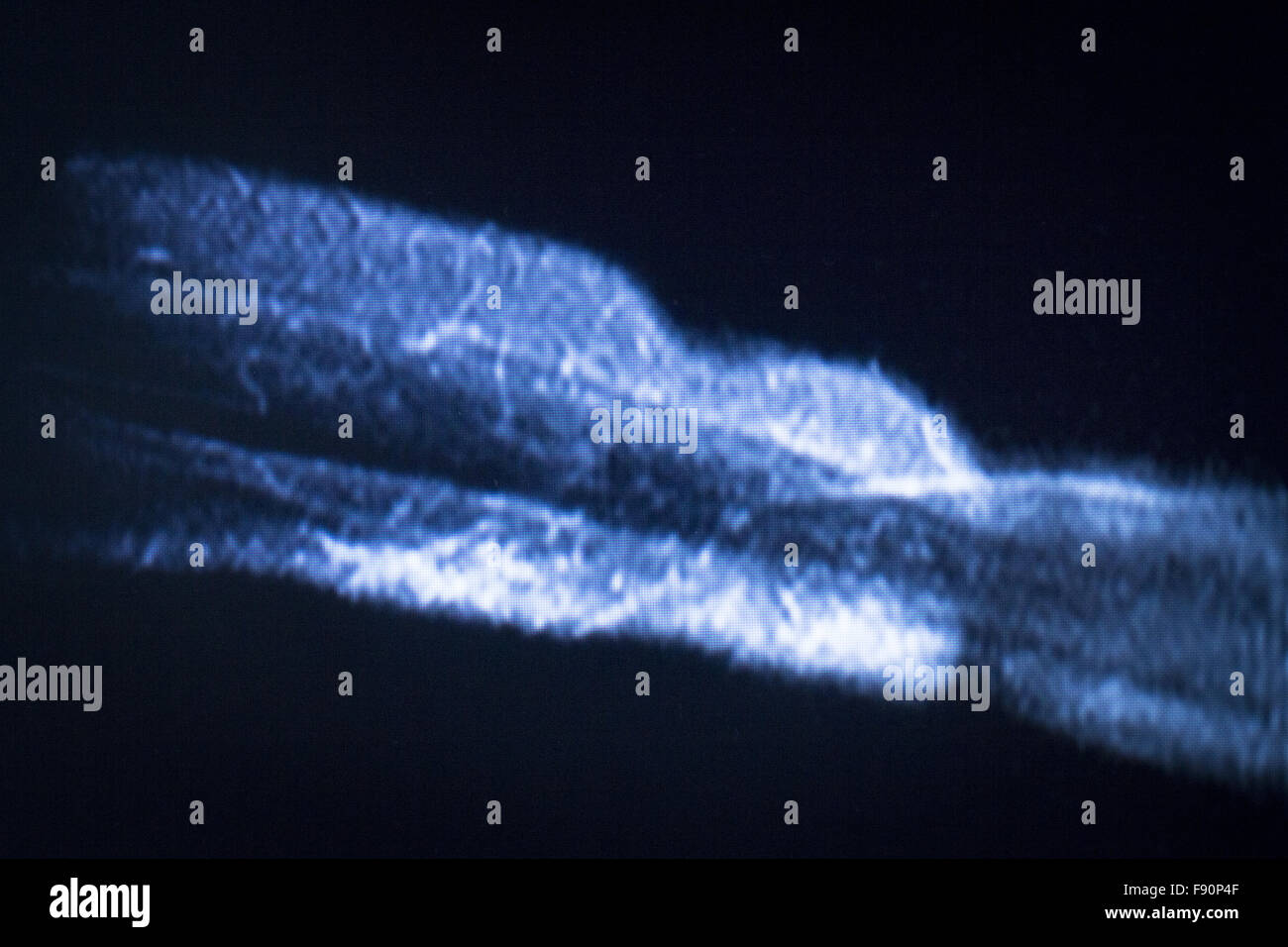 MRI resonance imaging medical scan test results showing