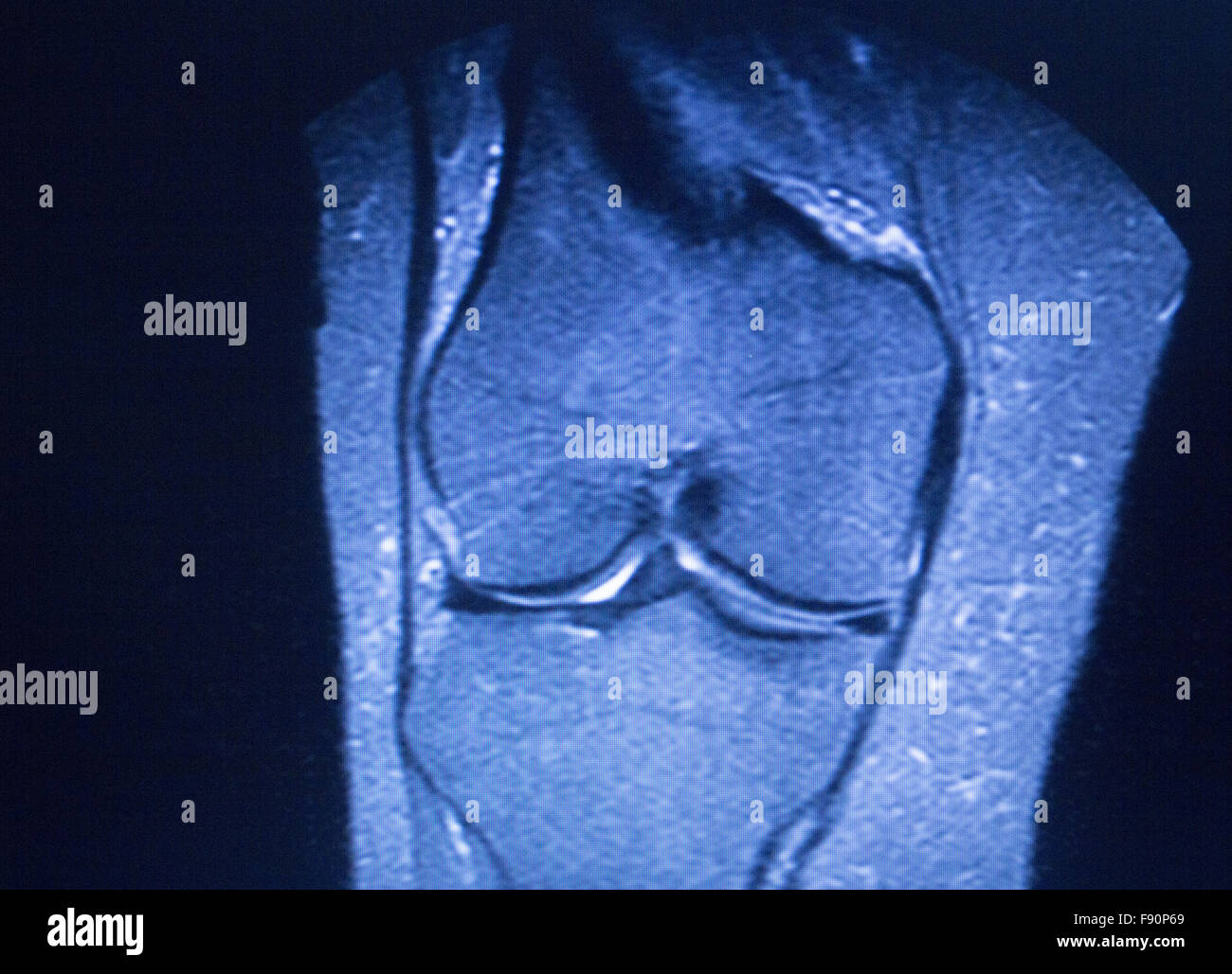 MRI resonance imaging medical scan test results showing
