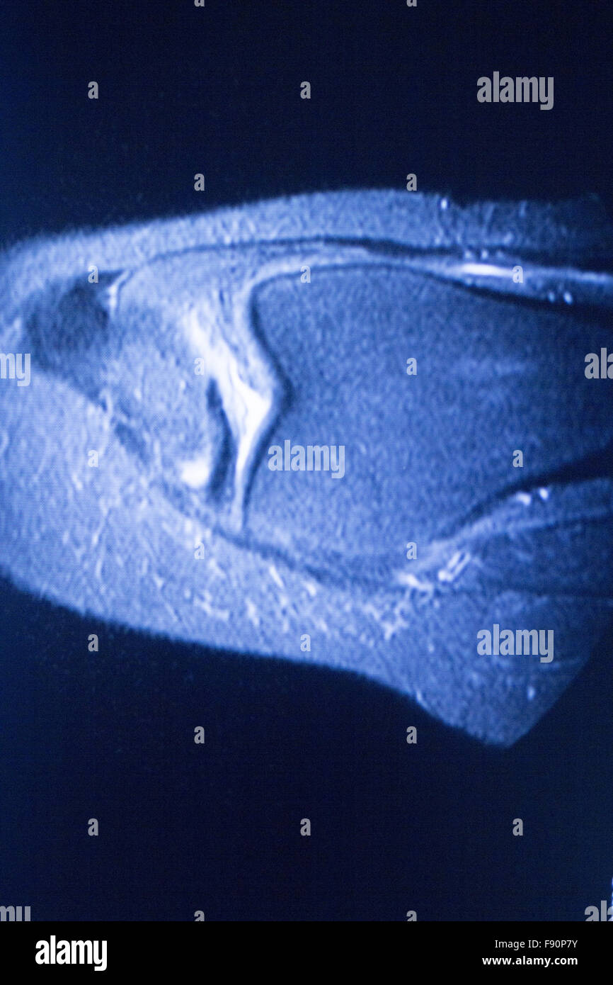 MRI resonance imaging medical scan test results showing