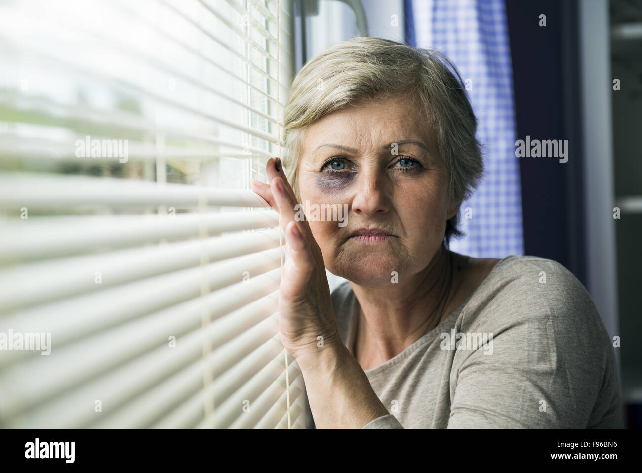 Scared woman is looking through the window. Having bruise on her face Stock Photo
