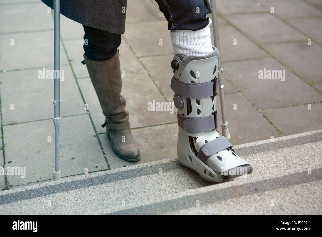 closeup of woman walking with a plaster cast and crutches Stock Photo