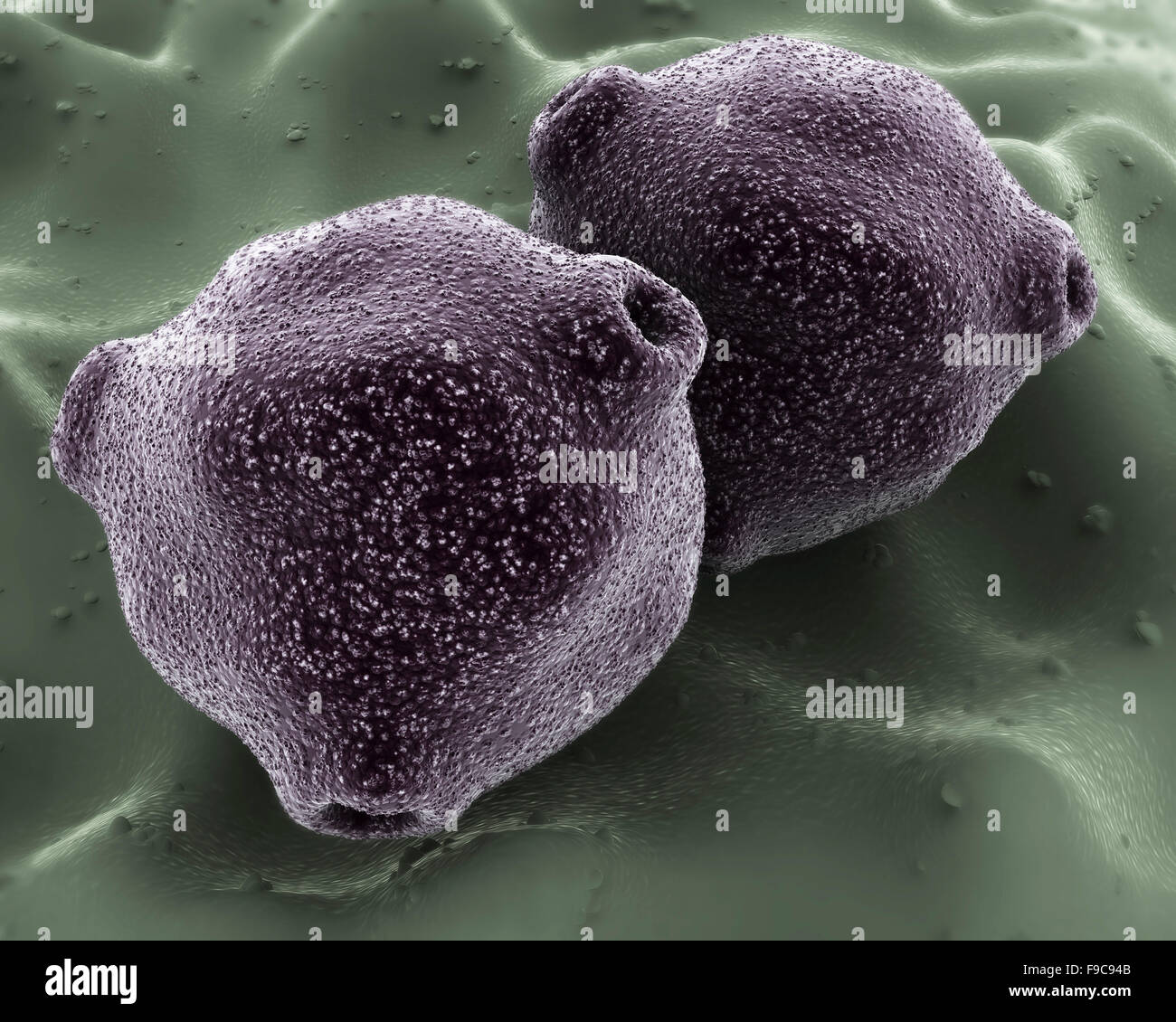 Microscopic view of birch tree pollen. Birch tree pollen is considered to be an important allergenic tree pollen. Stock Photo