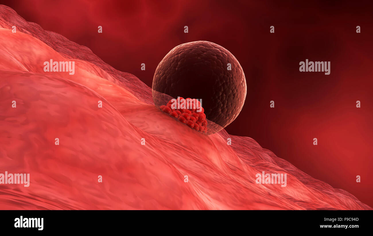 A blastocyst begins implanting in the wall of the uterus. Stock Photo