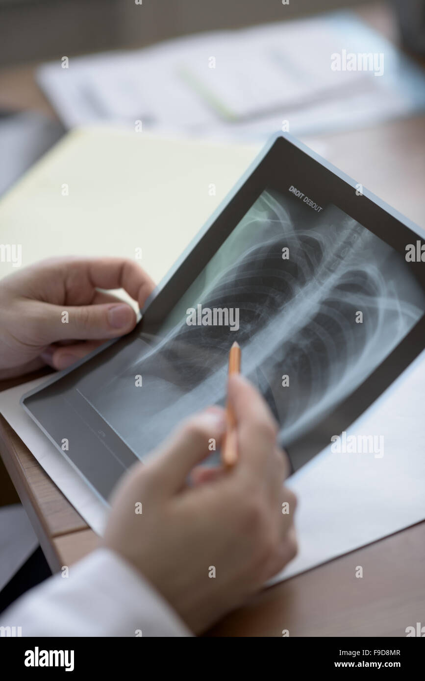 Hands of doctor holding chest and lungs xray in medical office Stock Photo
