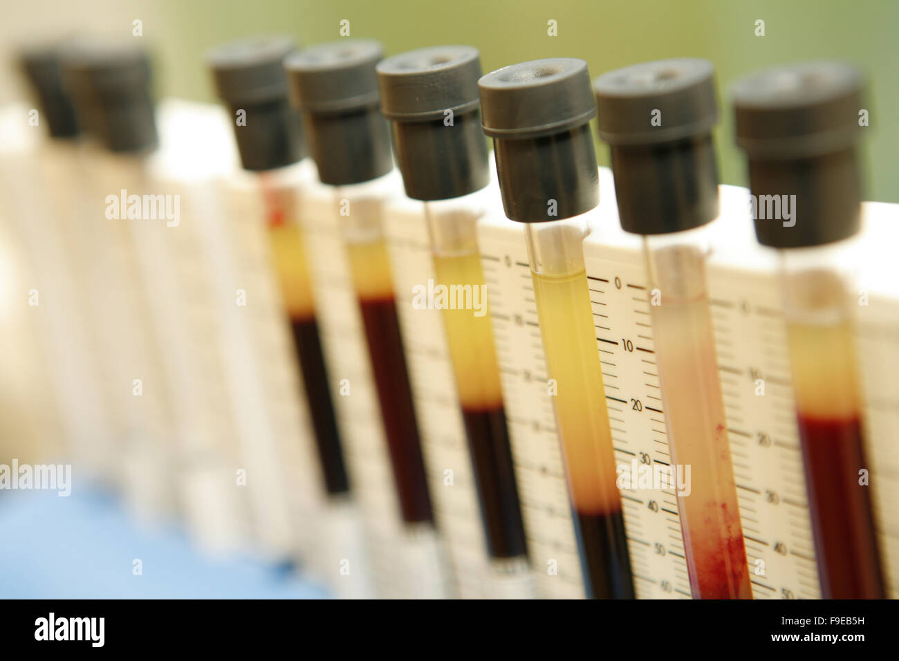Blood samples in tubes. Stock Photo