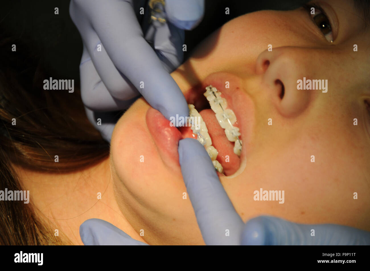 An orthodontist is a type of dentist who specializes in straightening