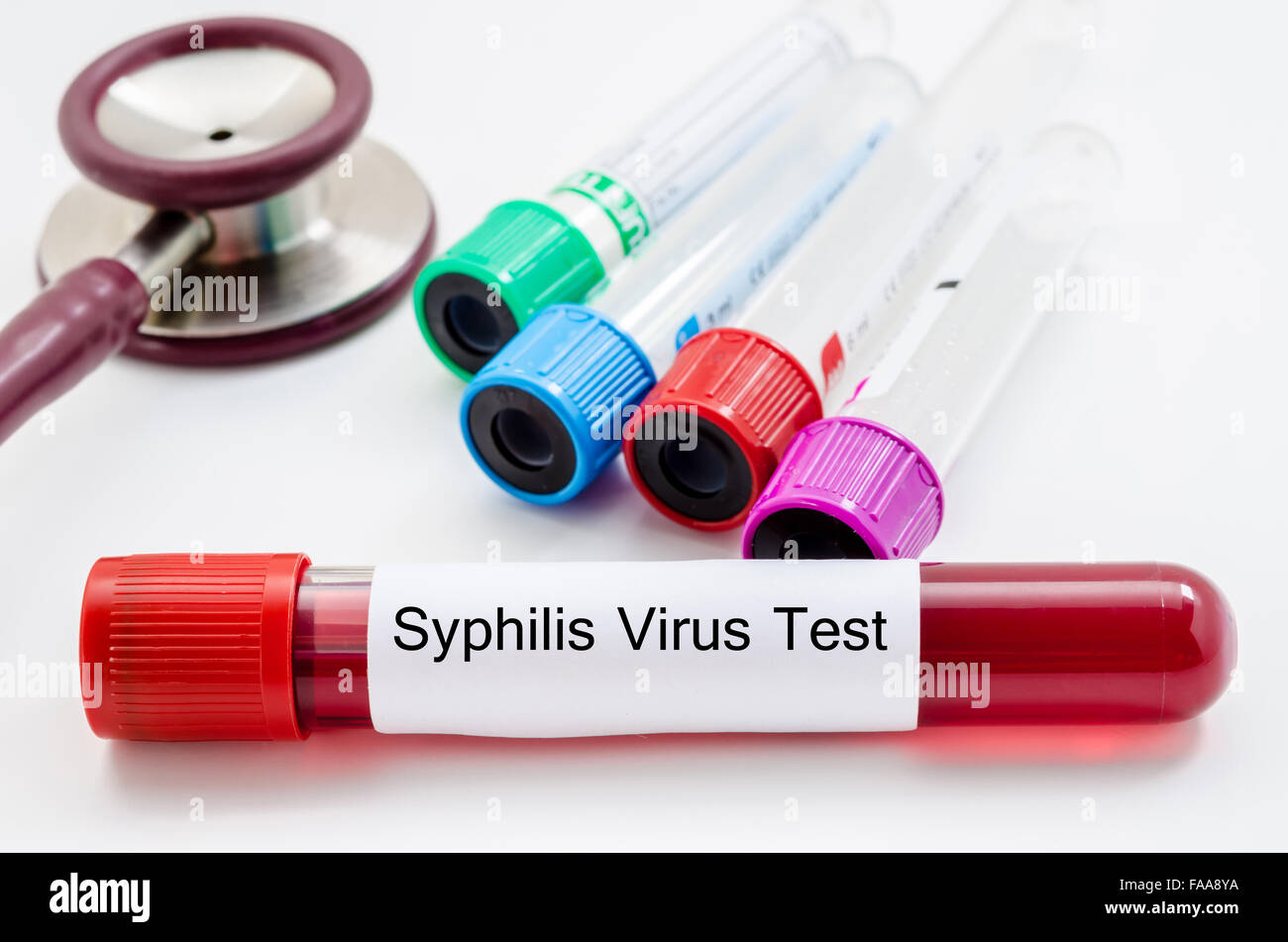 Syphilis virus blood sample collection tube with stethoscope on white background. Stock Photo