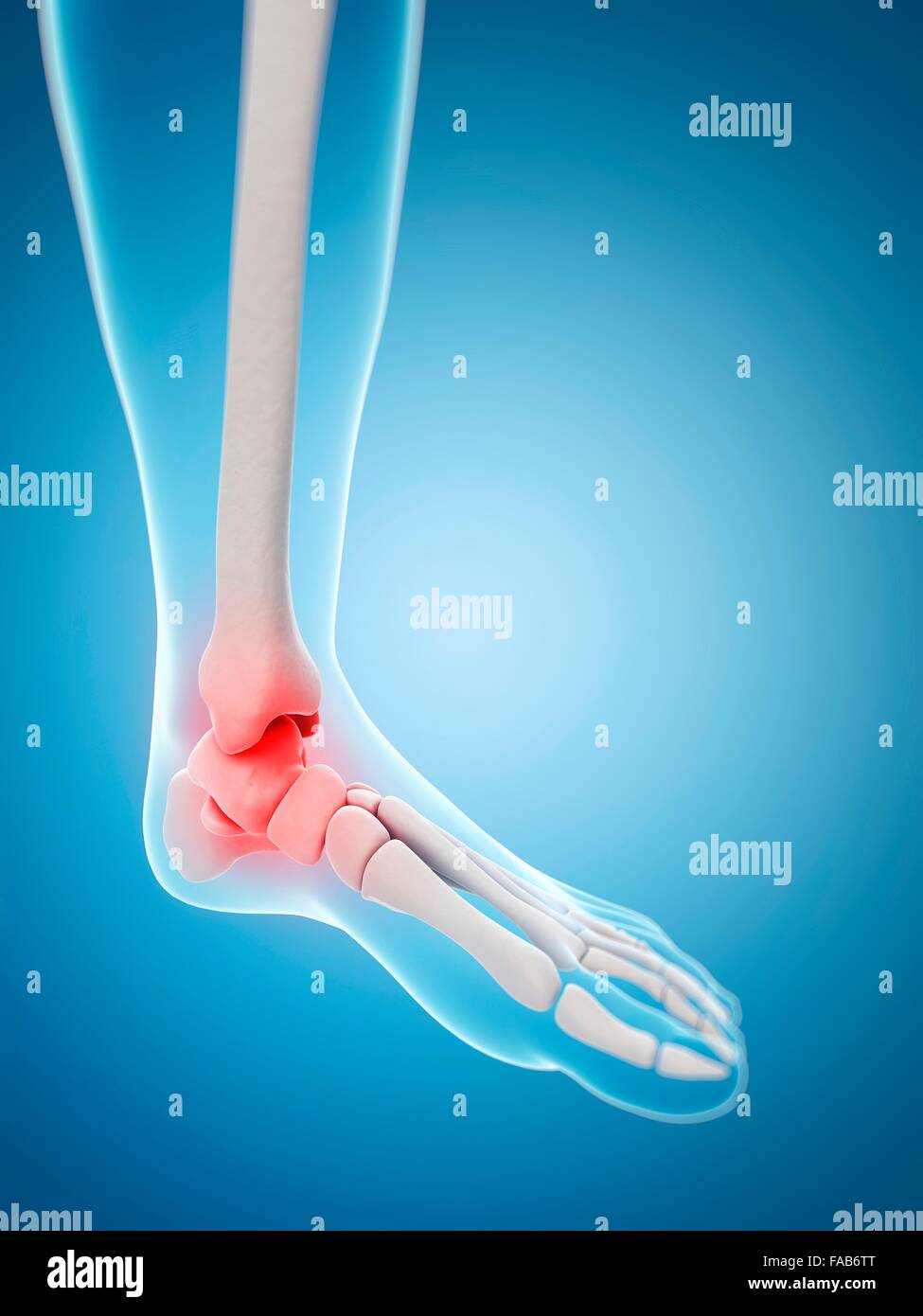Human ankle pain, computer illustration Stock Photo - Alamy