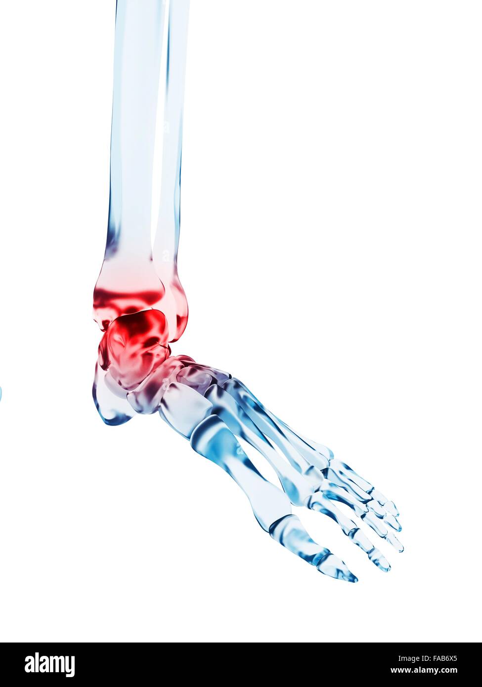 Human ankle pain, computer illustration Stock Photo - Alamy