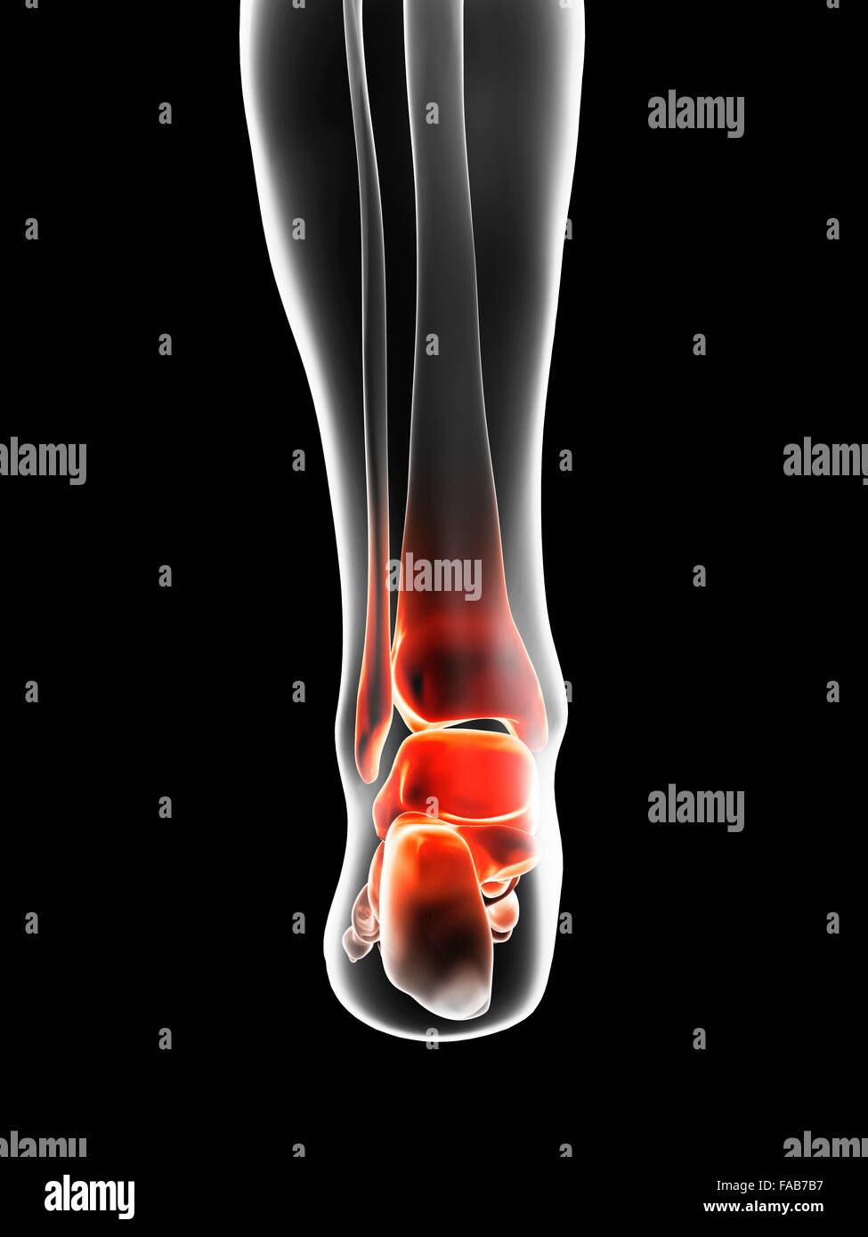 Human ankle pain, computer illustration Stock Photo - Alamy