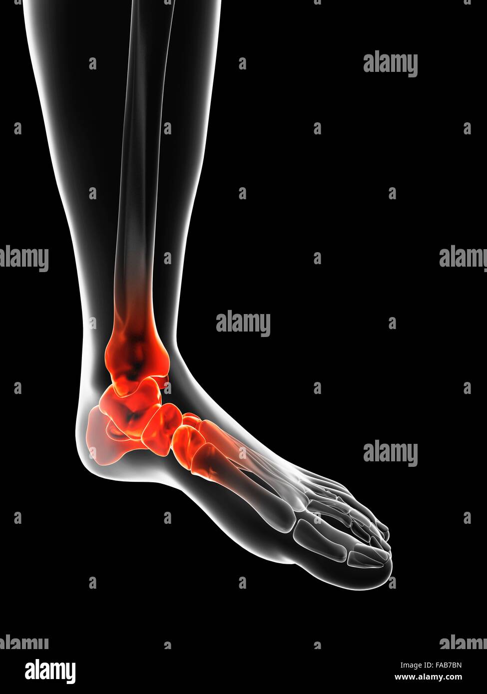 Human ankle pain, computer illustration Stock Photo - Alamy