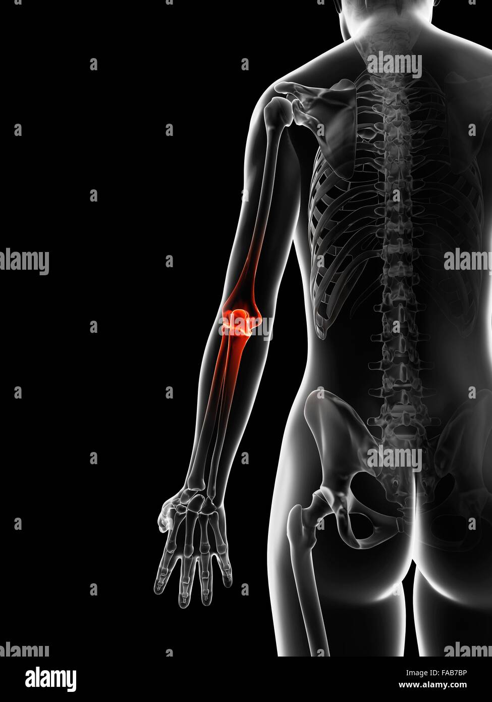 Human elbow pain, computer illustration Stock Photo Alamy