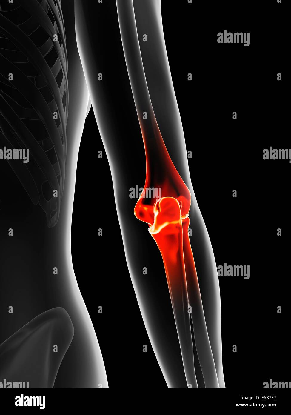 Human elbow pain, computer illustration Stock Photo Alamy