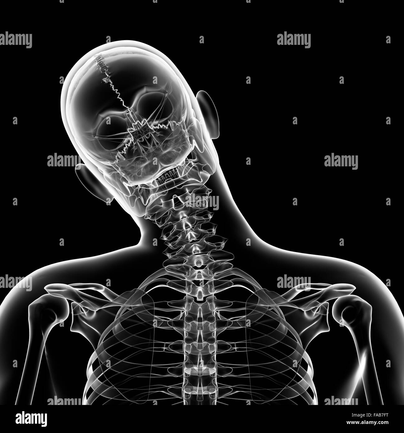 Human head bending sideways Black and White Stock Photos & Images Alamy