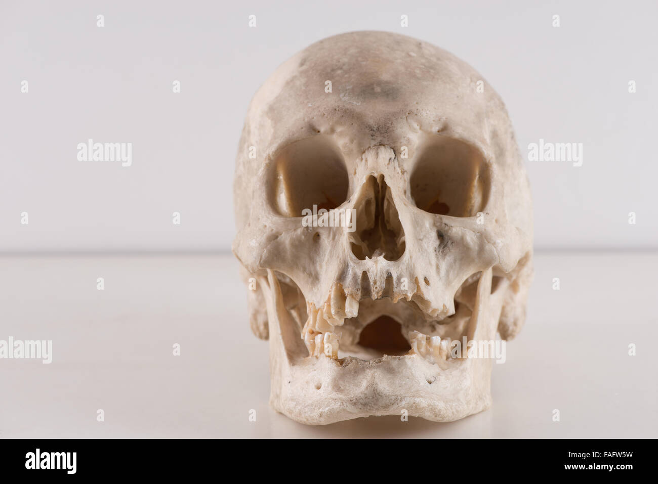 anatomy and physiology of real human skull cranium for scientific research slightly gruesome in studio pathology table Stock Photo