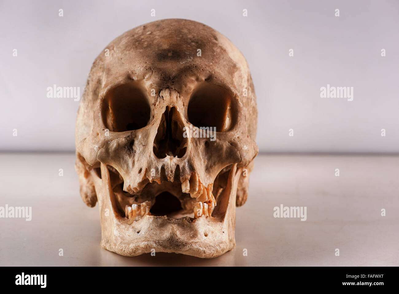 anatomy and physiology of real human skull cranium for scientific research slightly gruesome in studio pathology table Stock Photo