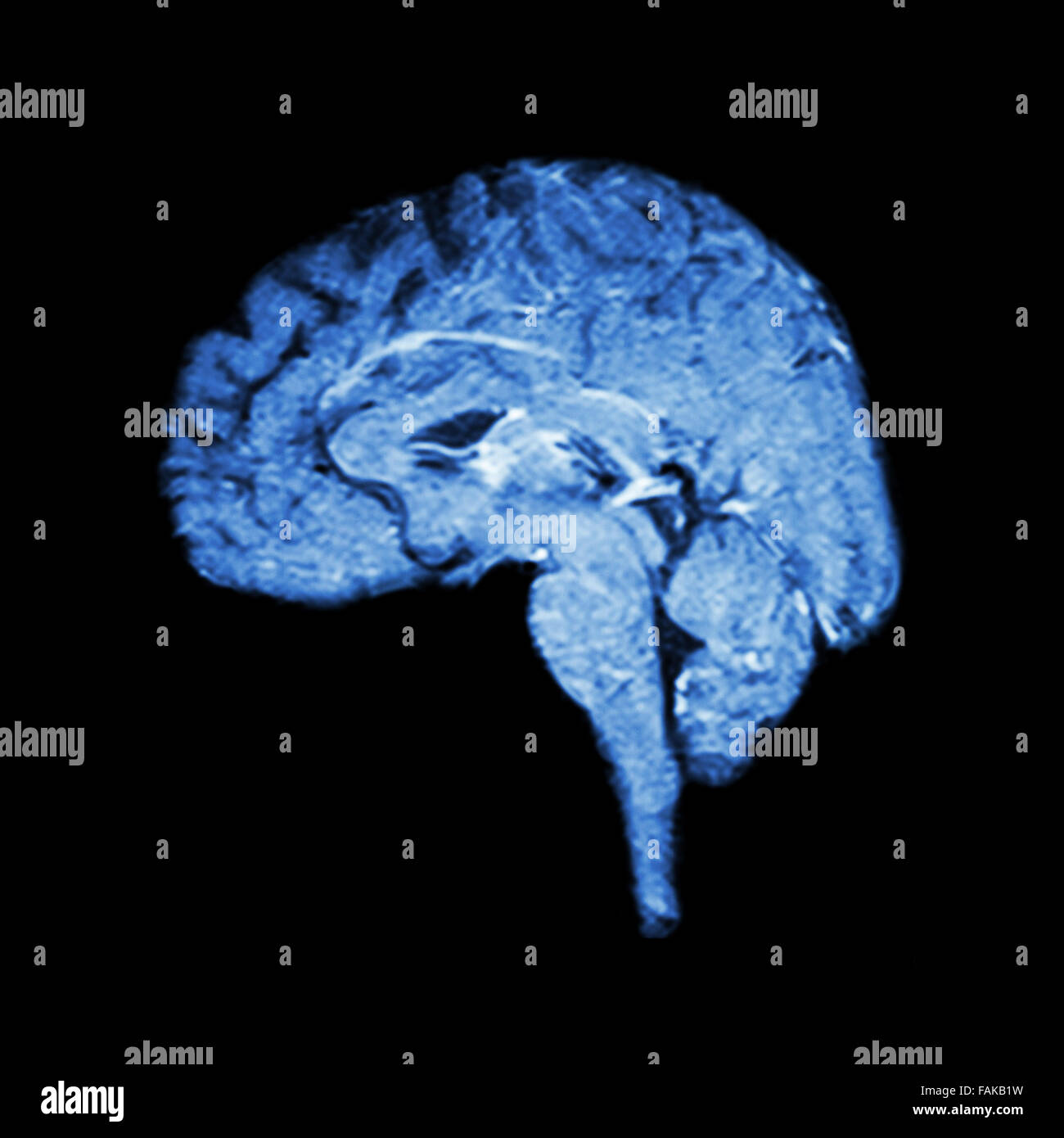 Cardiovascular Magnetic Resonance Imaging (Contemporary