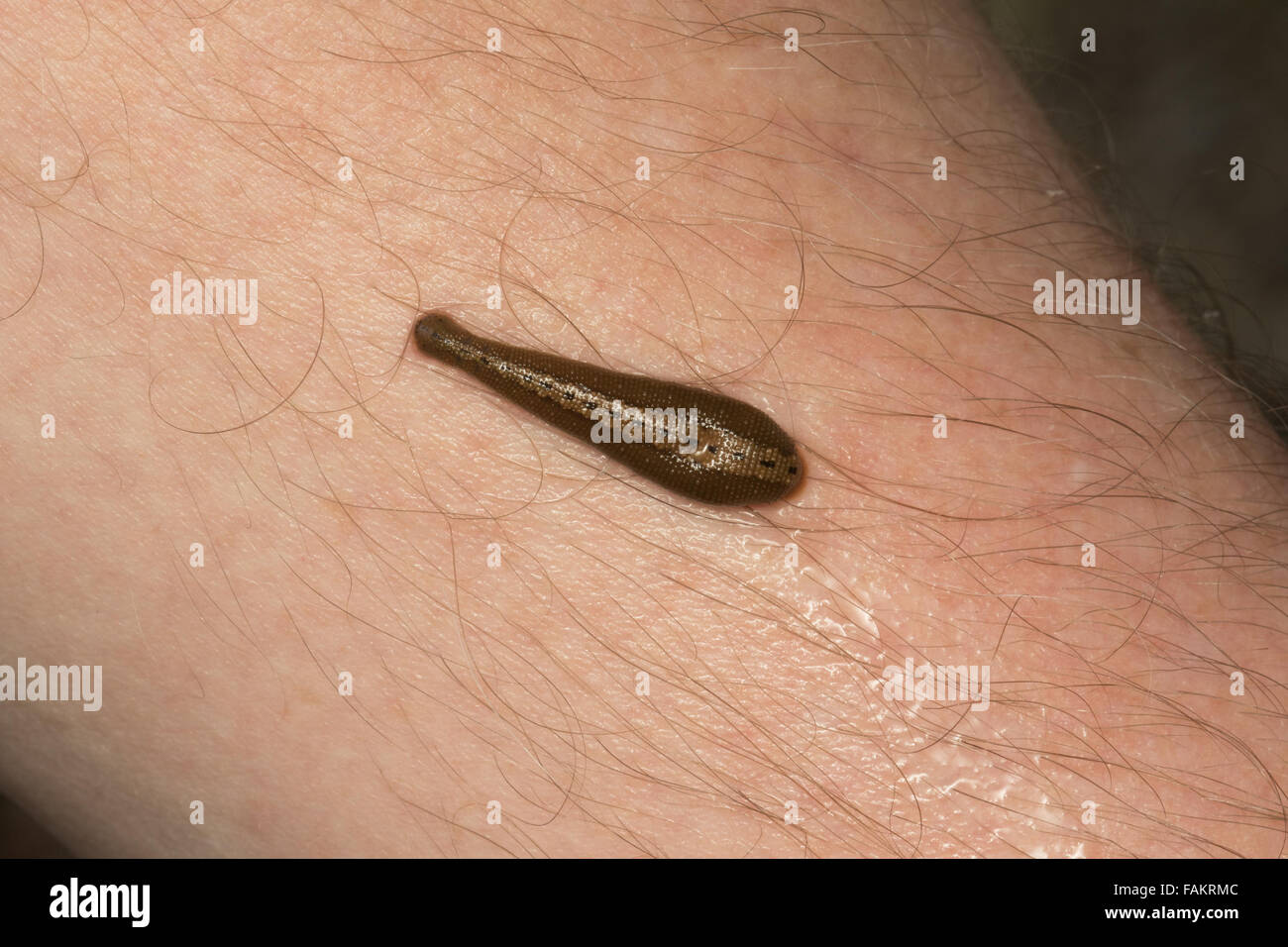 Leech hirudinaria on human male hi-res stock photography and images - Alamy