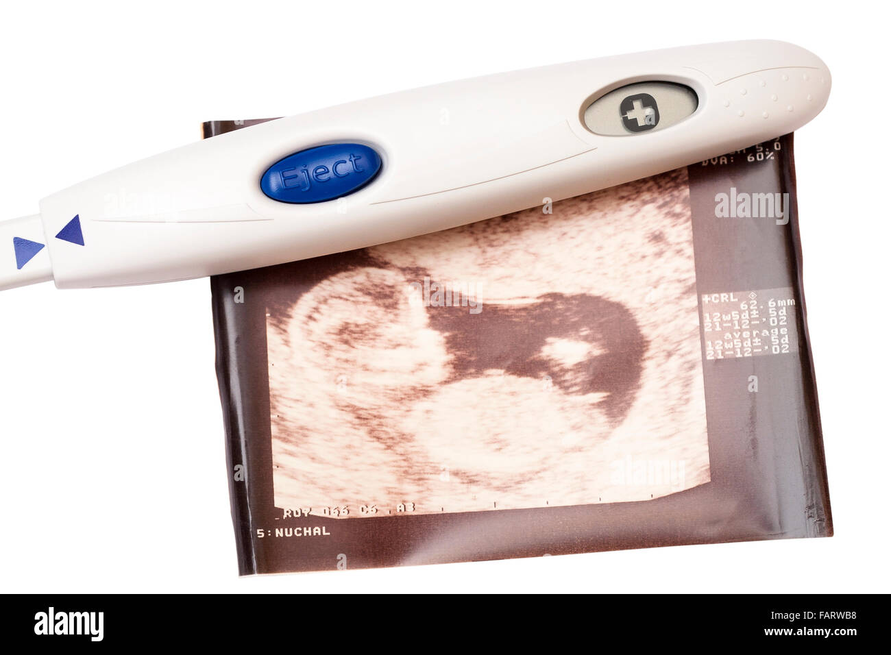 Positive pregnancy test and ultrasound picture isolated on white