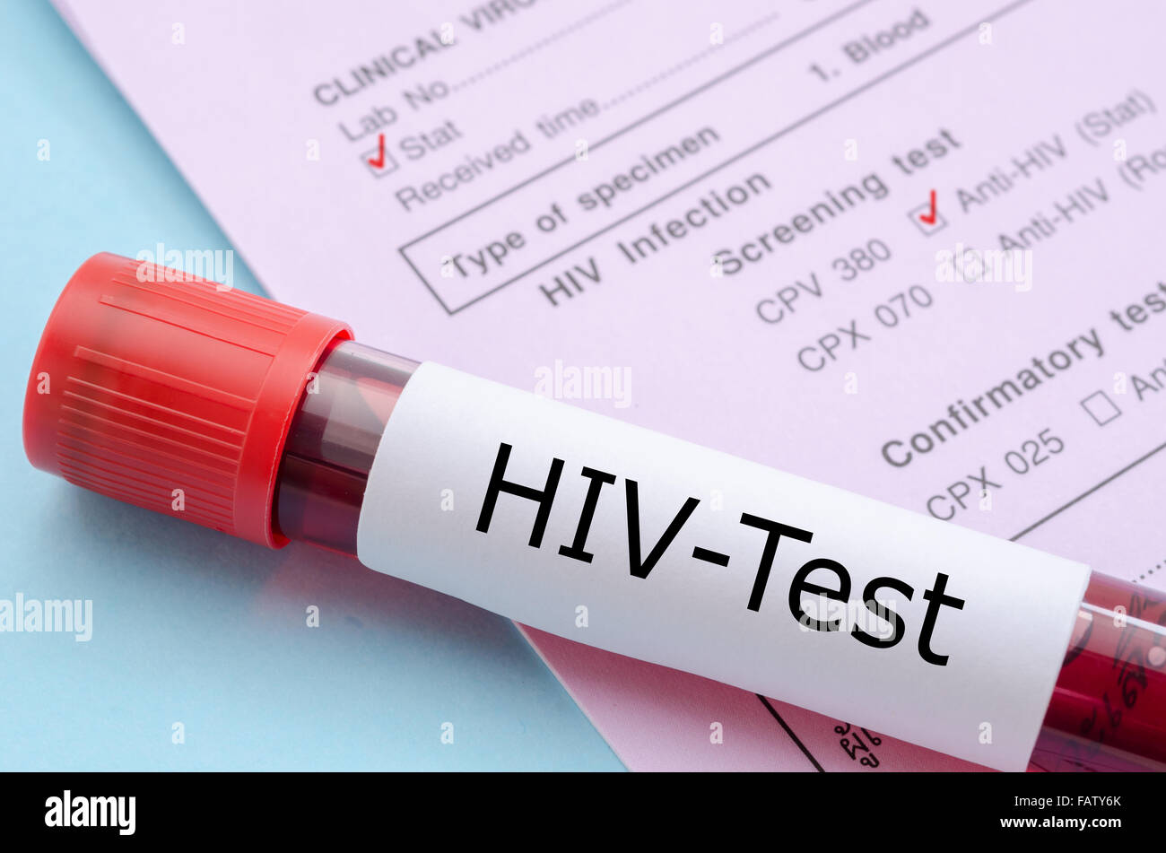 Sample blood collection tube with HIV test label on HIV infection screening test form. Stock Photo