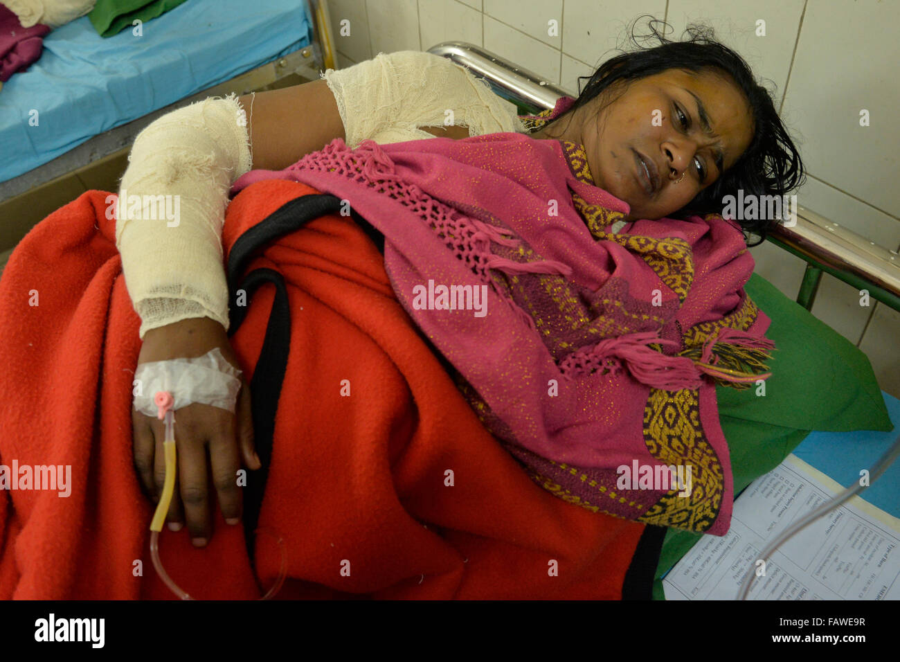 Dhaka, Bangladesh. 05th Jan, 2016. A housewife named as Sonia Akhter, 28, was burnt in an acid attack carried out by miscreants at Mohammadpur in Dhaka early today. She was rushed to the burn unit of Dhaka Medical College and Hospital in Bangladesh. On January 05, 2016 Credit:  Mamunur Rashid/Alamy Live News Stock Photo