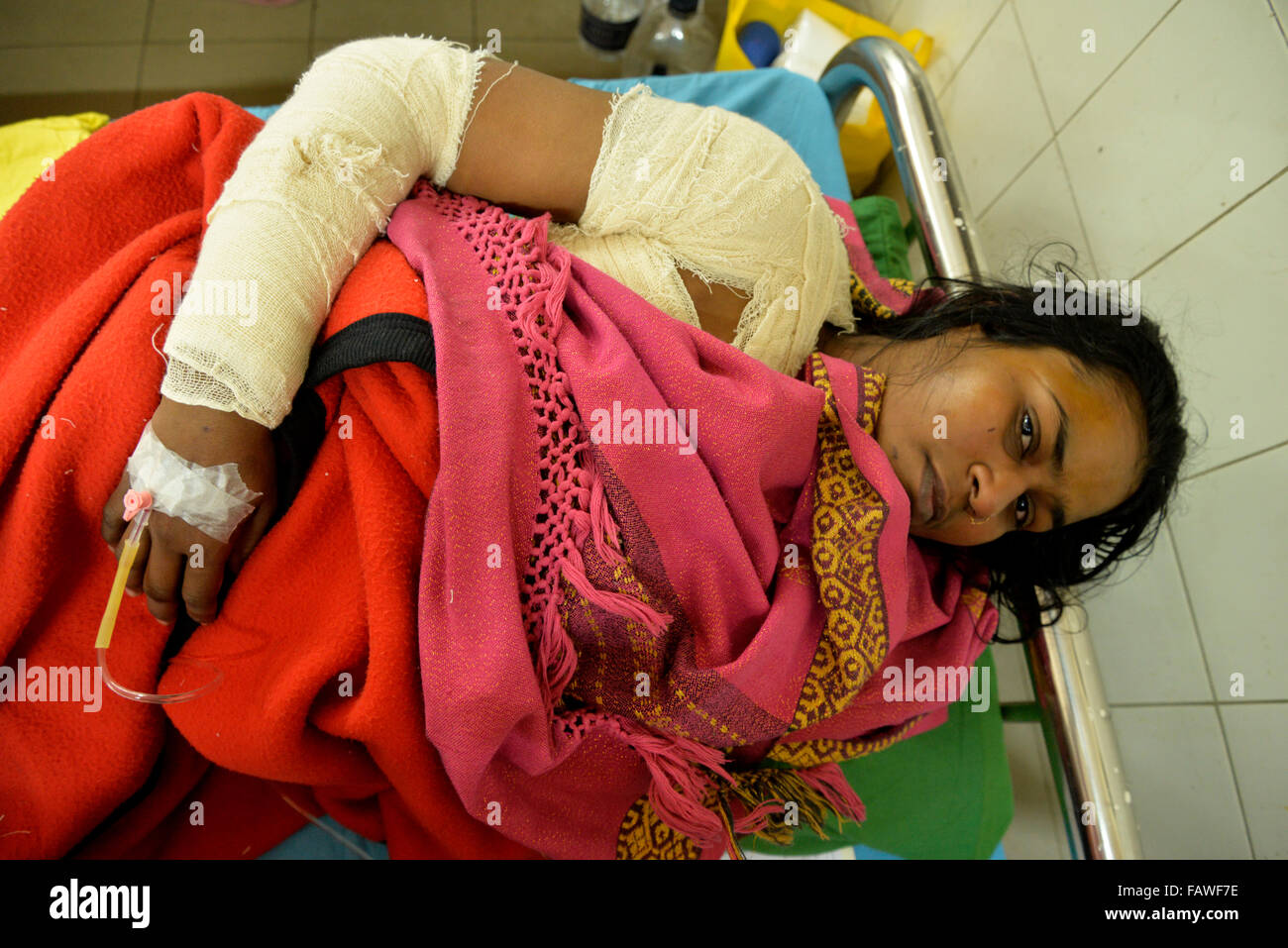 Dhaka, Bangladesh. 05th Jan, 2016. A housewife named as Sonia Akhter, 28, was burnt in an acid attack carried out by miscreants at Mohammadpur in Dhaka early today. She was rushed to the burn unit of Dhaka Medical College and Hospital in Bangladesh. On January 05, 2016 Credit:  Mamunur Rashid/Alamy Live News Stock Photo