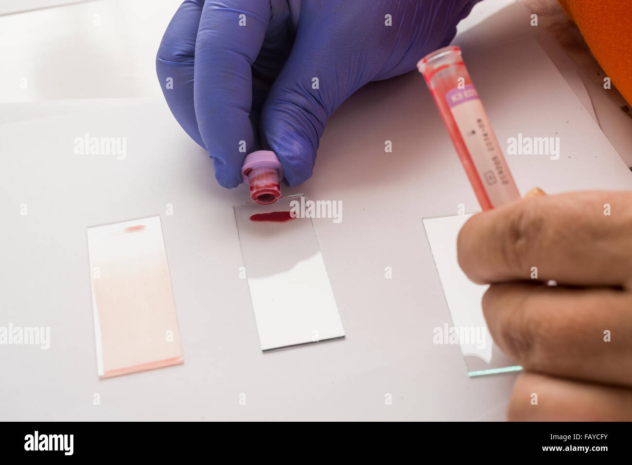 Blood test in a laboratory Stock Photo