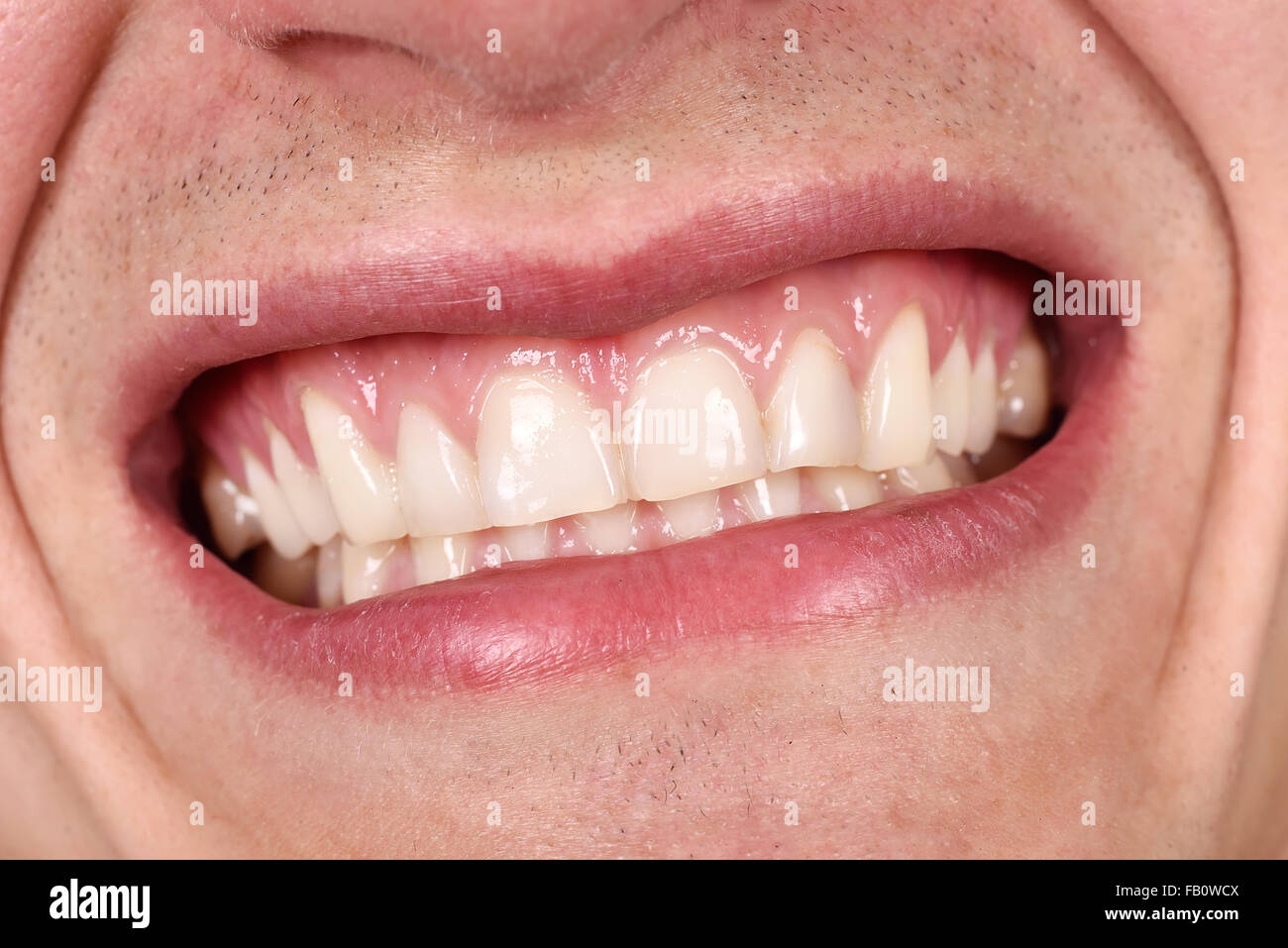 male mouth laughing and showing his teeth, close up Stock Photo Alamy