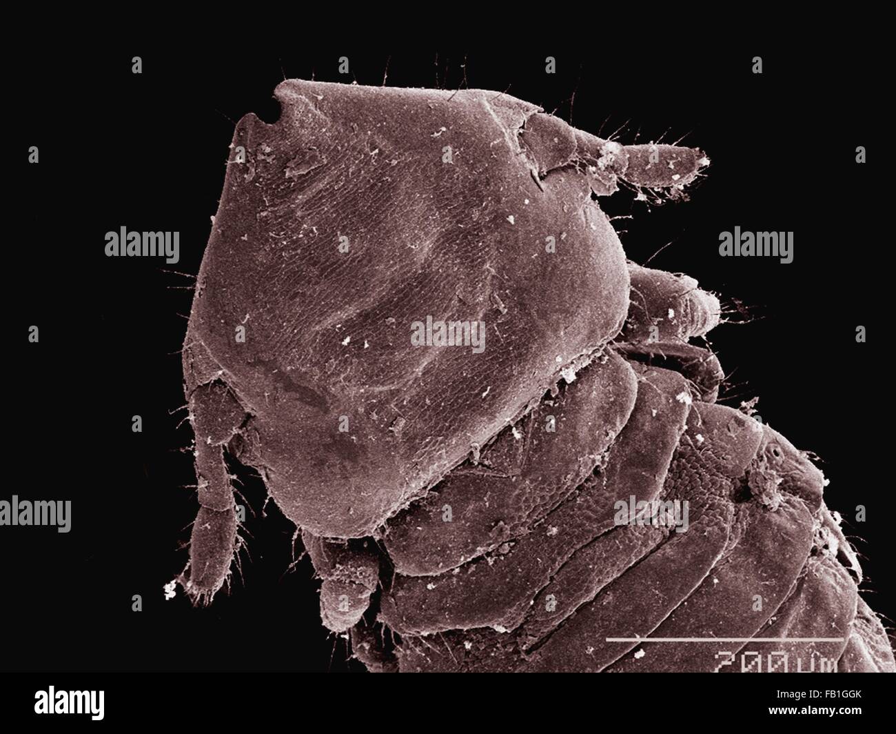 Cat Dander Electron Microscope