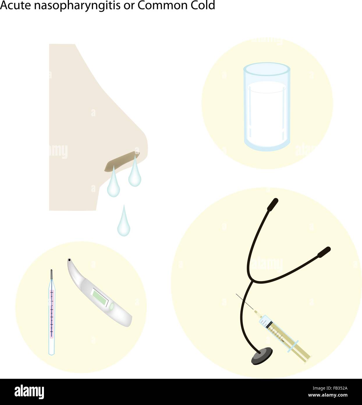 Medical Concept, Illustration of Common Cold, Nasopharyngitis ...
