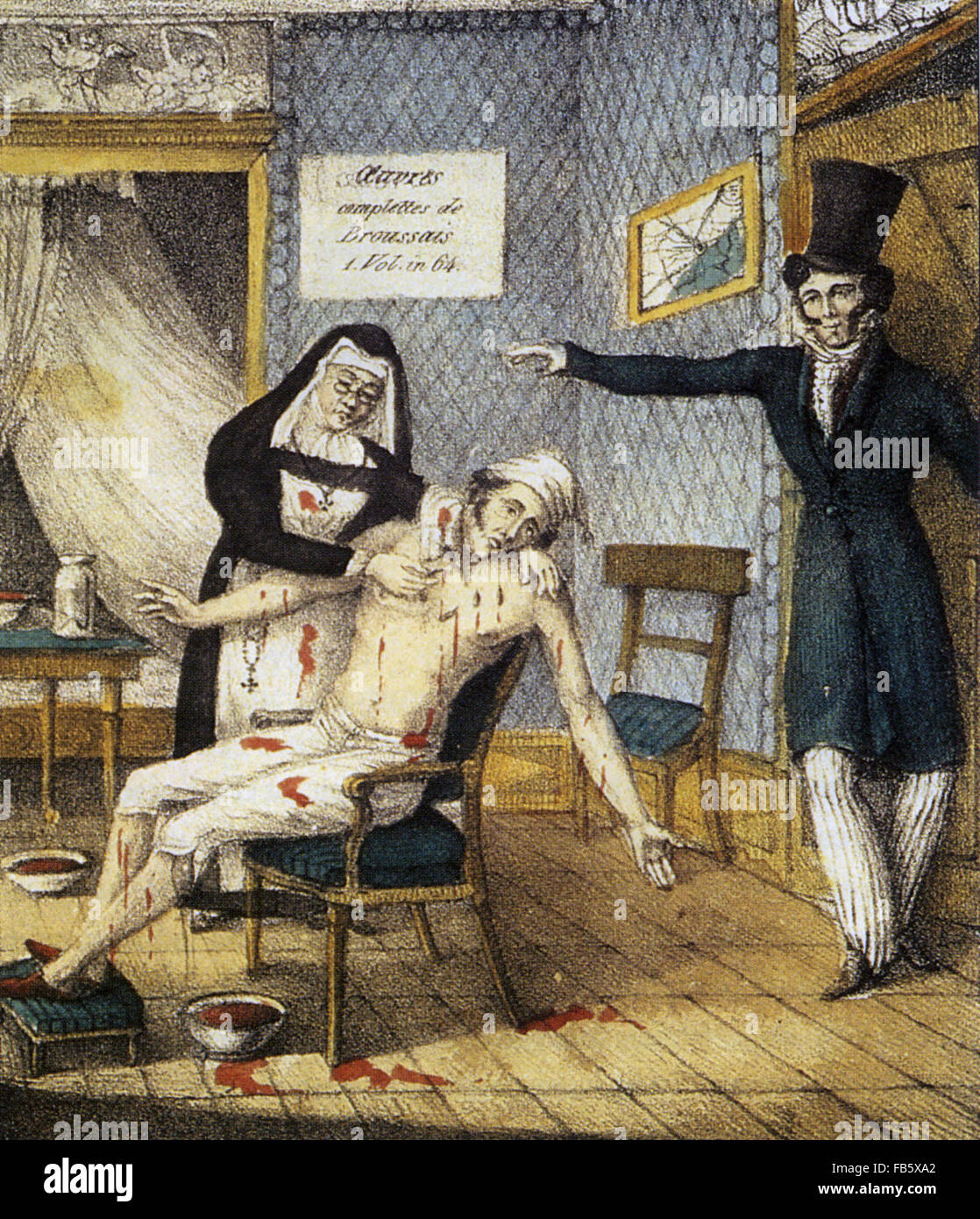 FRANCOIS BROUSSAIS (1772-1838) French physician. Lithograph about 1810 shows Broussais instructing a nurse to continue with the blood letting procedure of which he was a great advocate. Stock Photo