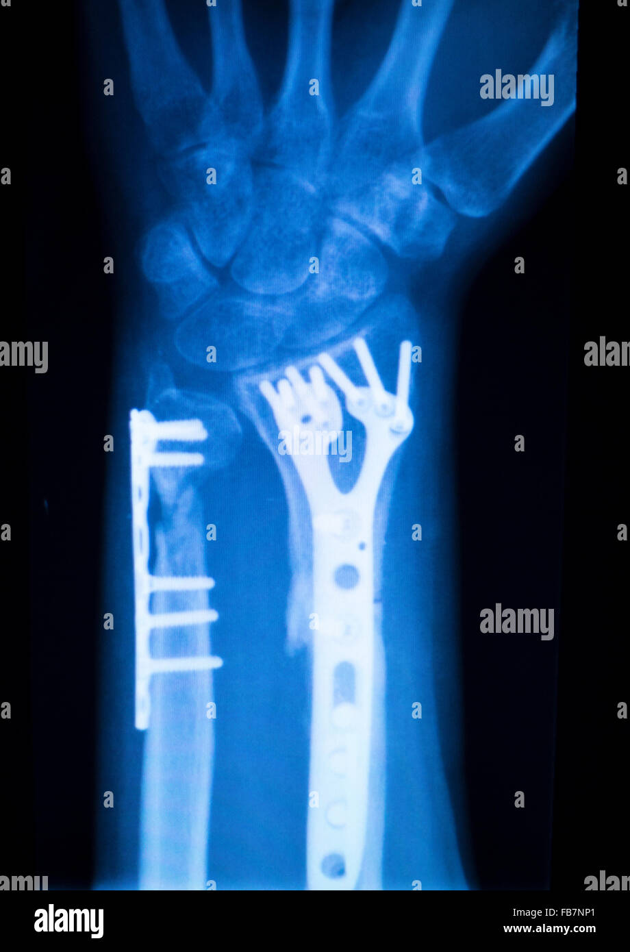hand hand fingers thumb plates Pictures of sex positions and vaginas