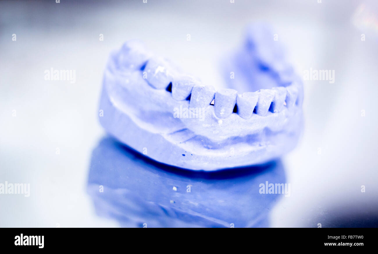 Dental prosthetics clay tooth mold in dentists photo Stock Photo Alamy