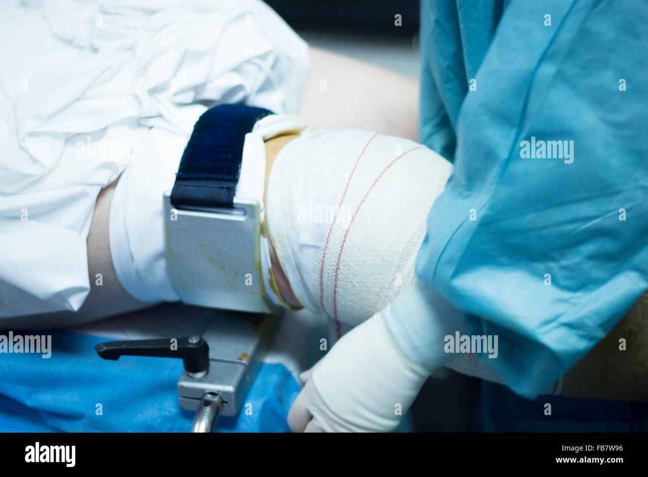 Операция по замене коленного сустава москва. Ортопедические операции. Операция на коленный сустав.