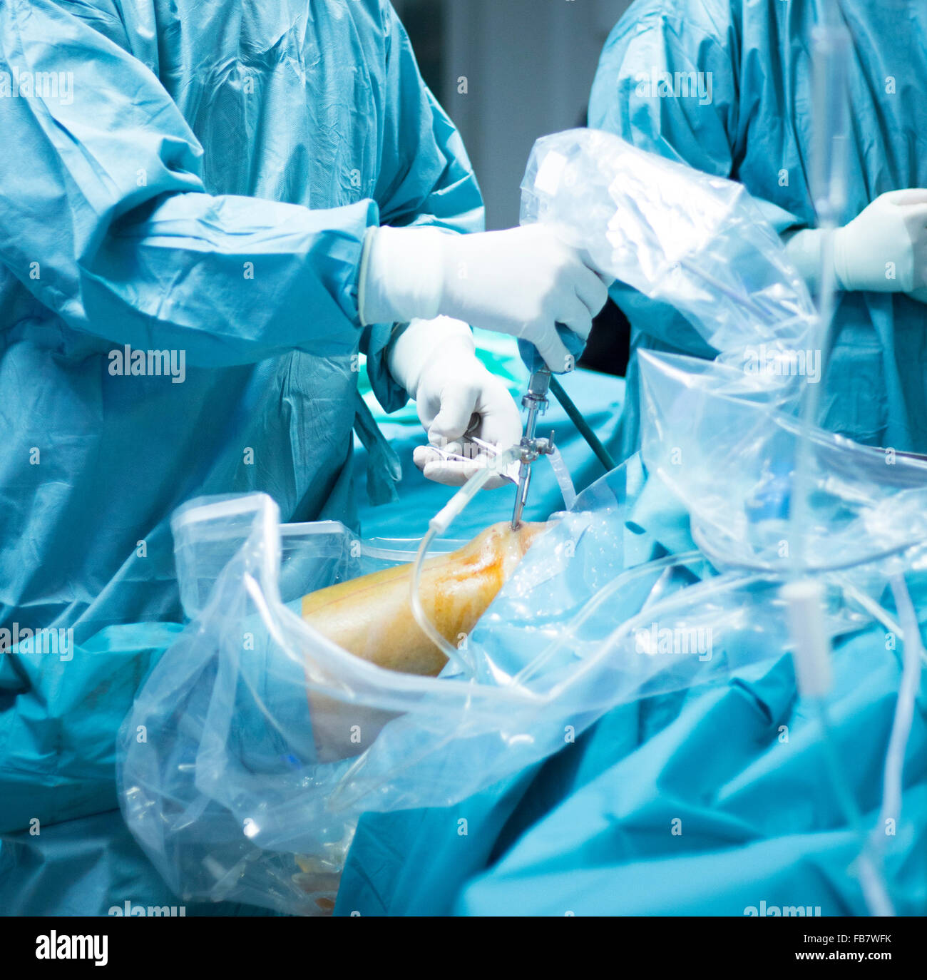 Knee arthroscopy orthopedic surgery operation in hospital operating