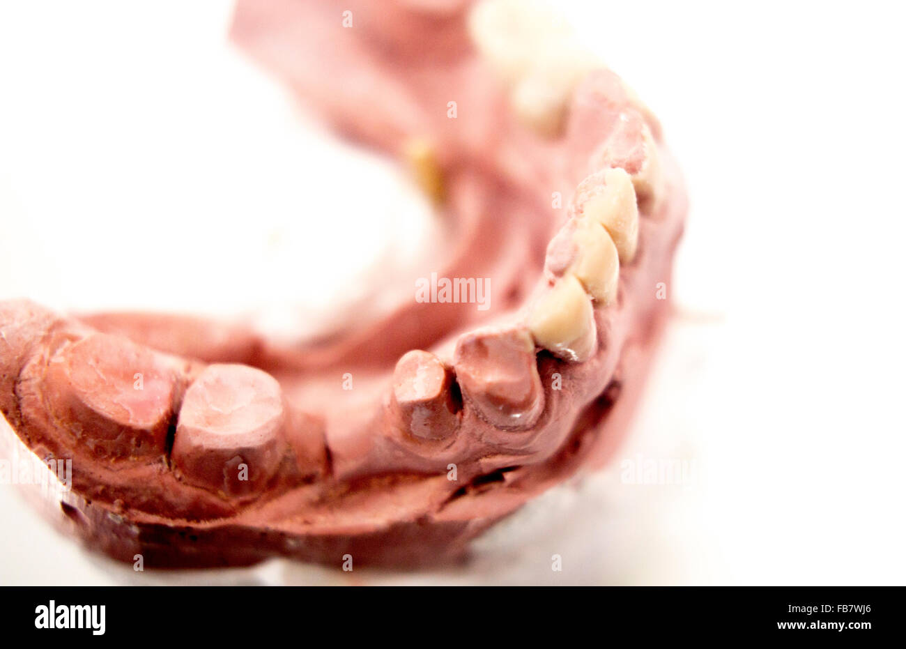 Dental prosthetics clay tooth mold in dentists photo Stock Photo Alamy