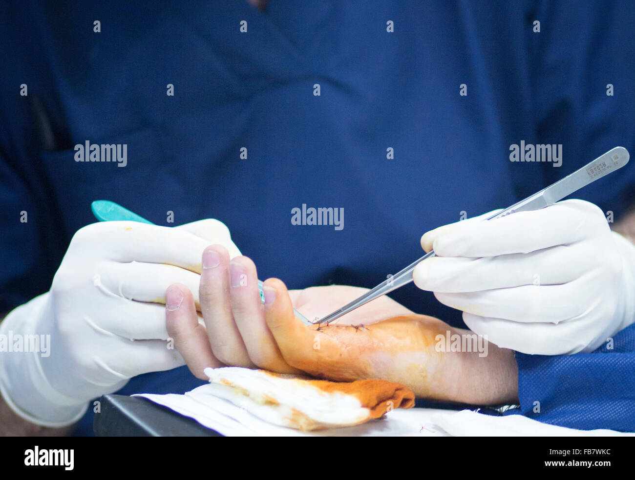 Hospital hand surgery orthopedics operation photo Stock Photo Alamy