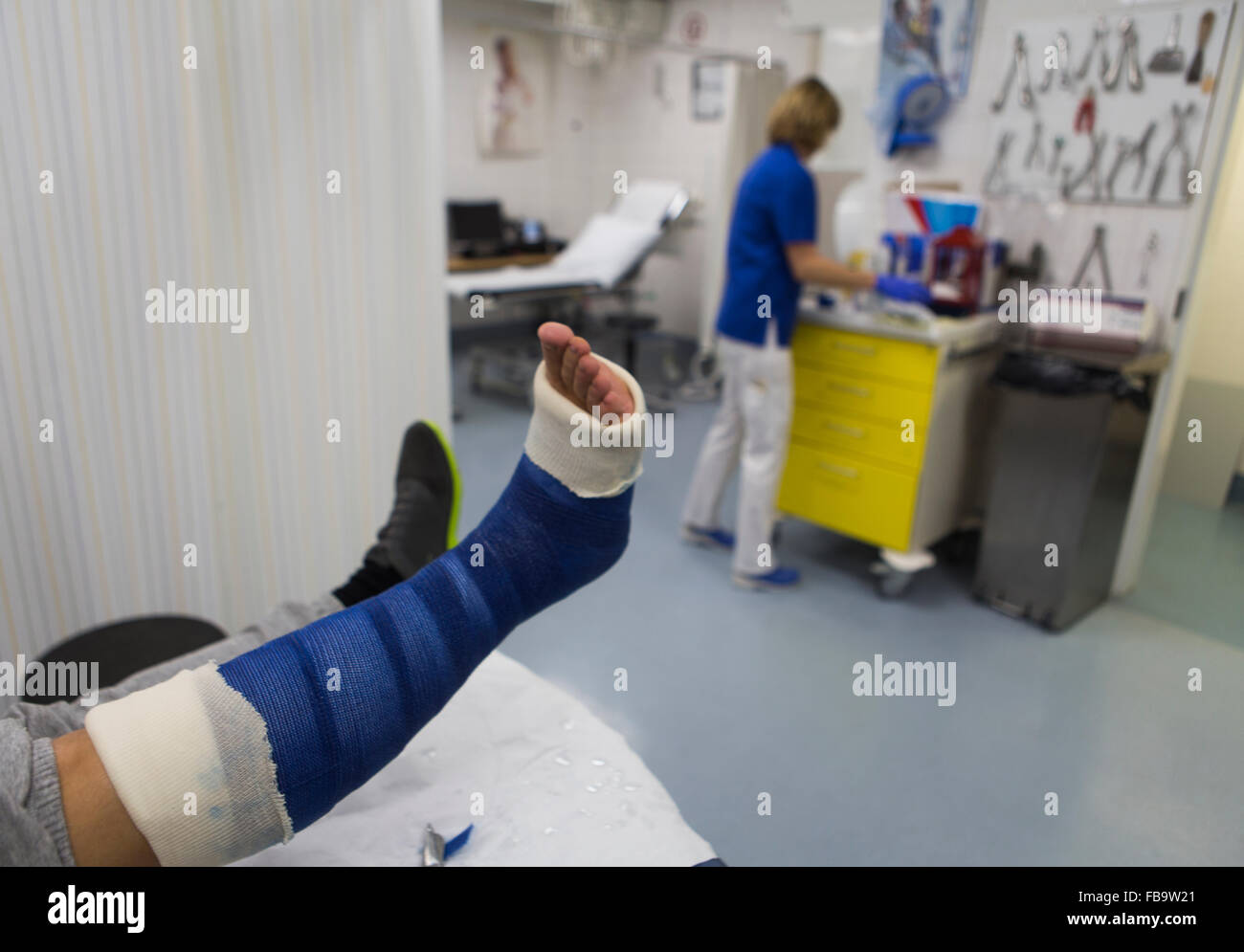 plaster cast on a fractured leg Stock Photo Alamy